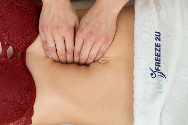 diastasis recti treatment Dunstable