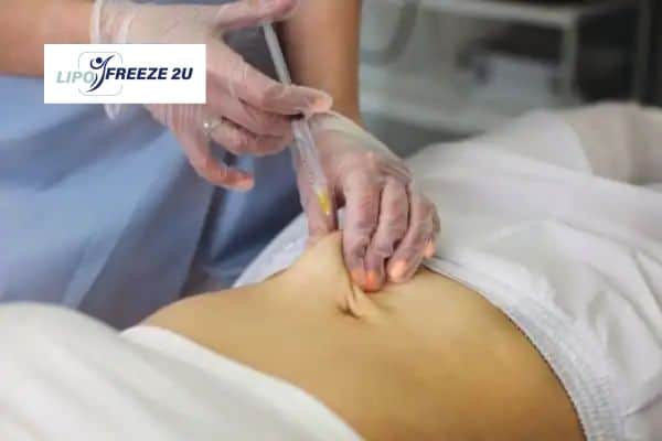 Fat Dissolving Injections Dunstable & Weight loss medication