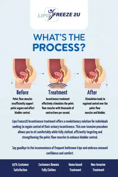 Diagram of how incontinence treatment Dunstable works.