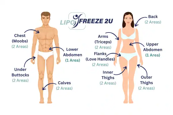 Areas you can have fat freezing treatment Dunstable