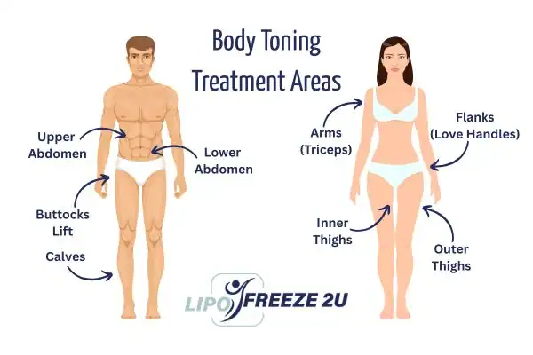Graphic showing where you can have Body toning Treatment Dunstable on your body