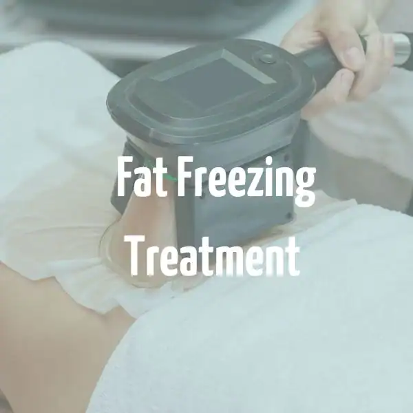 fat freezing treatment Dunstable