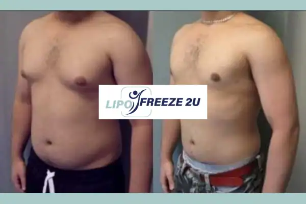 How Long Does It Take to See Results Dunstable?