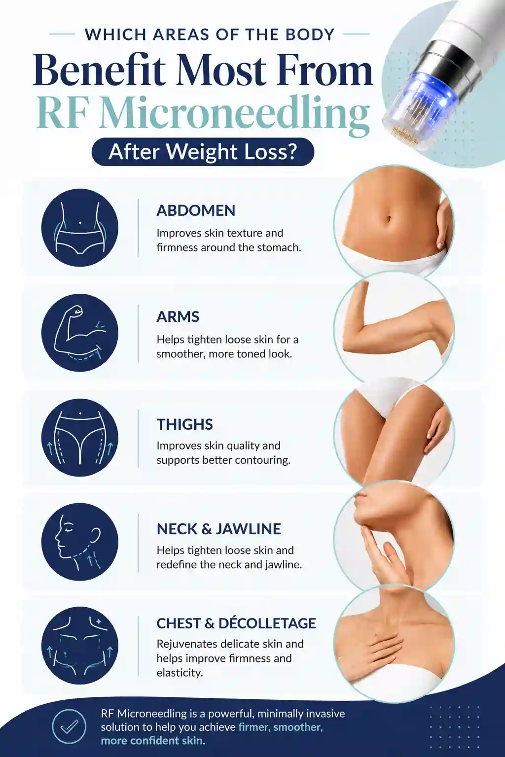 Which Areas of the Body Benefit Most From RF Microneedling After Weight Loss Dunstable
